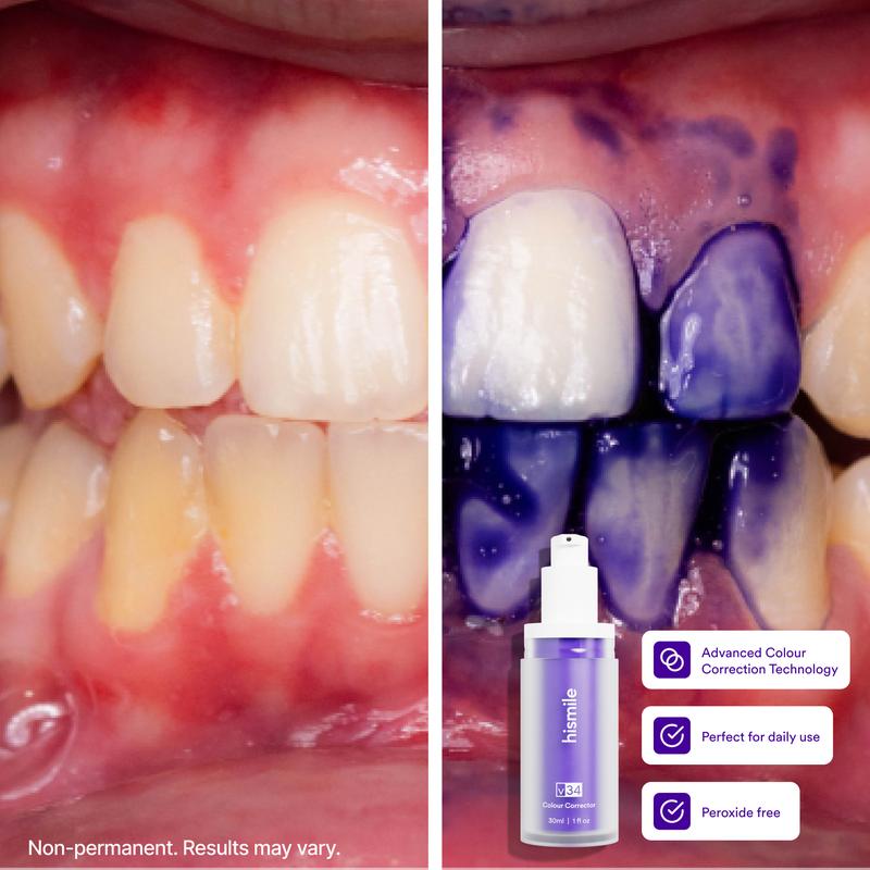[Recommended by Kim Kardashian] Hismile V34 Colour Corrector - Tooth Stain Concealer, Temporary Brightening Booster, product image 3