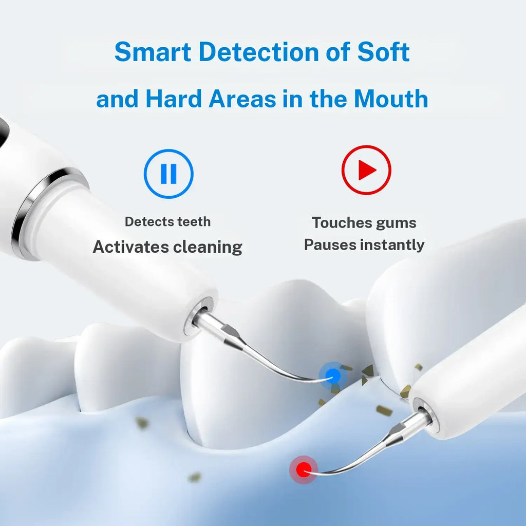 CURVY MOON Ultrasonic Dental Plaque and Tartar Remover ,Professional Teeth Cleaning Kit for Tartar & Stains Removal, product image 8