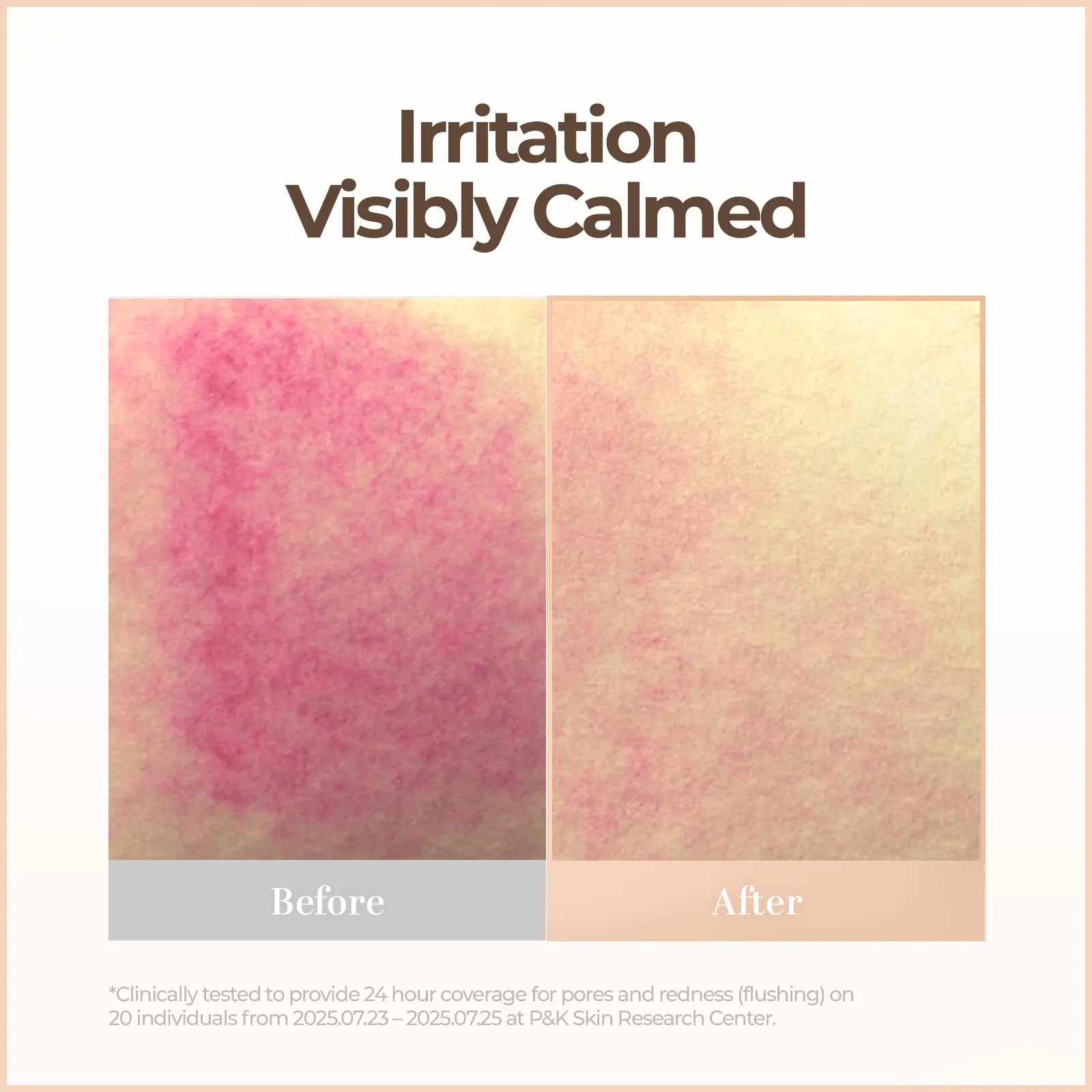 Cell Fusion C Skin Blemish Balm Intensive | Skin Tint for Recovery | 5 Ceramides & 6 Peptides | Buildable Tone-Up product image 6