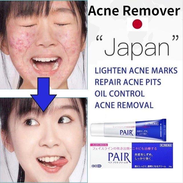 Lion Pair Acne Cream Acne Treatment Pimples Removal Cream Pair Acne Creamy Foam Facial Wash Gentle Antibacterial product image 5