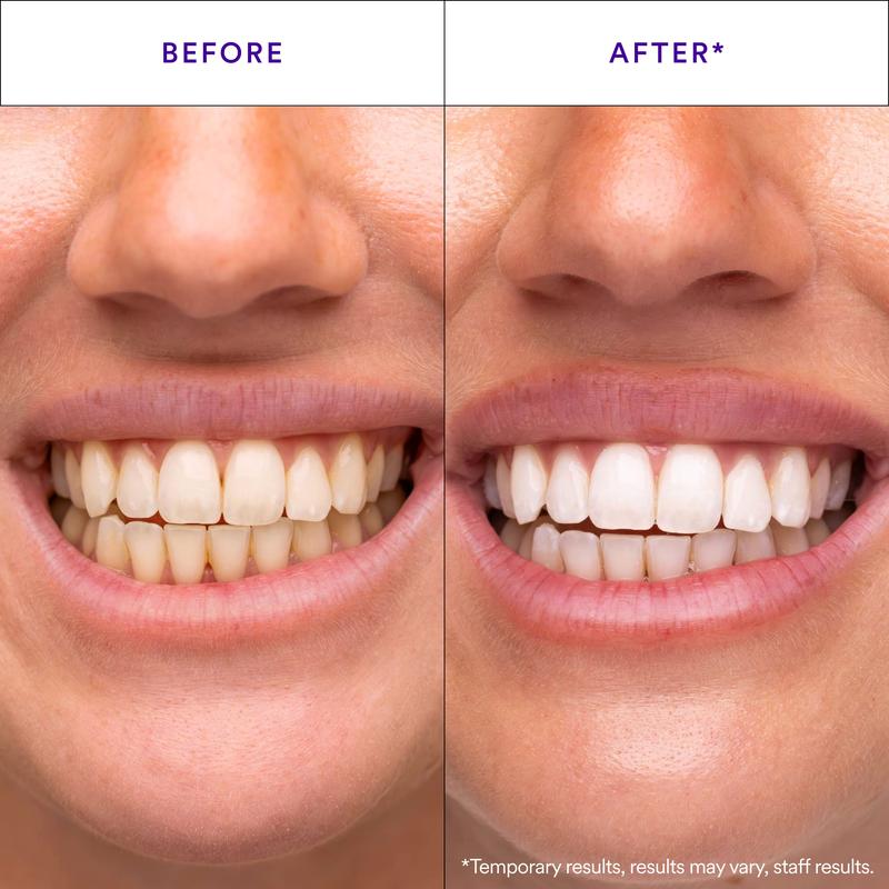 Hismile V34 Whitening Strips, Teeth Whitening Strips, Purple Tooth Whitening, Combining Whitening and Colour Correction product image 2